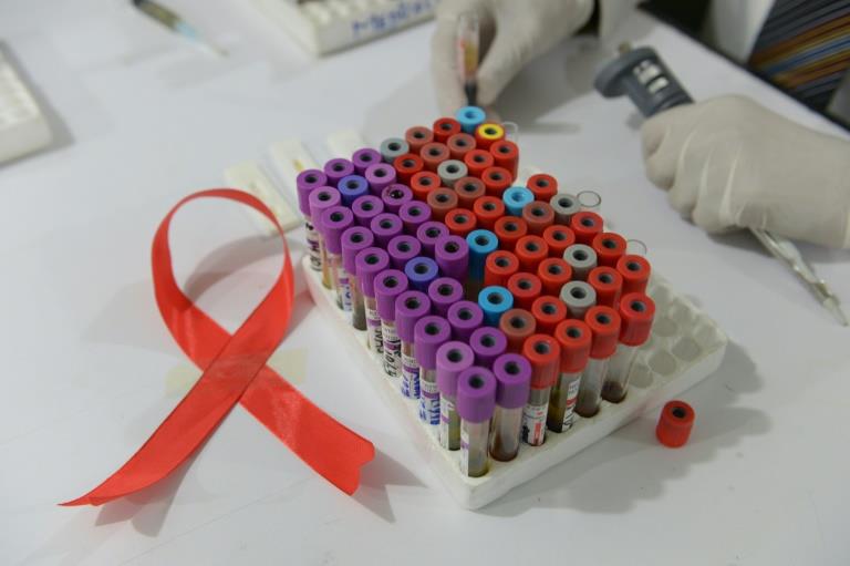 'Elephantiasis' virus may boost AIDS risk: study