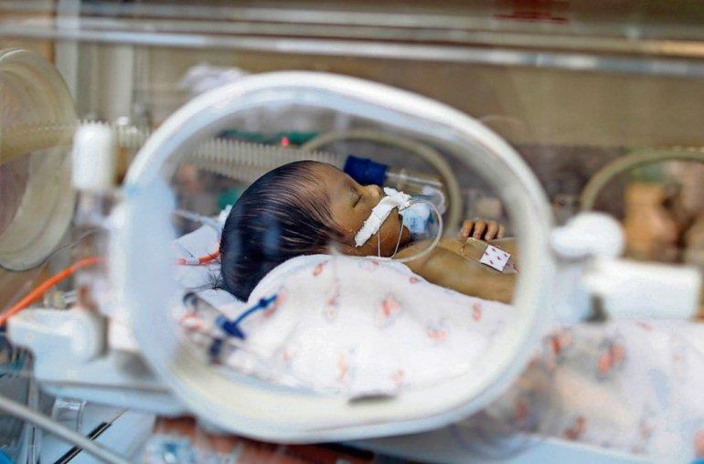 AI may help evaluate brain maturity in preterm infants