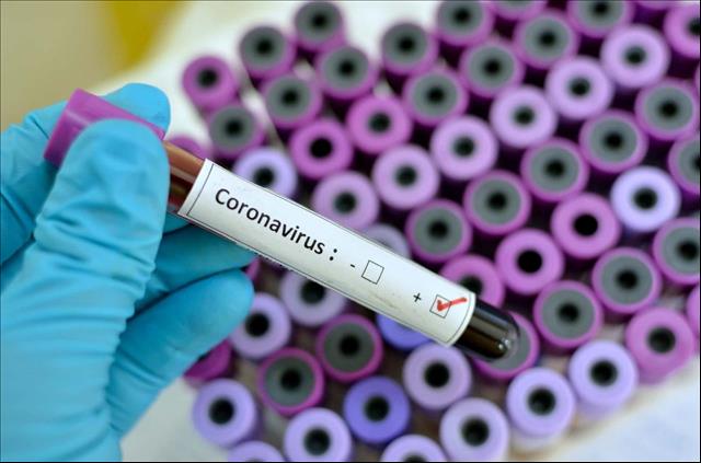 Baku accounts for half of COVID-19 cases in Azerbaijan - Vimarsana News