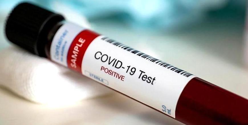 Jordan- 9 COVID deaths, 1,638 virus cases recorded on Thursday - Vimarsana News