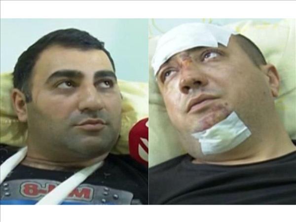 Treatment of servicemen injured in helicopter crash of Azerbaijan's State Border Service continues
