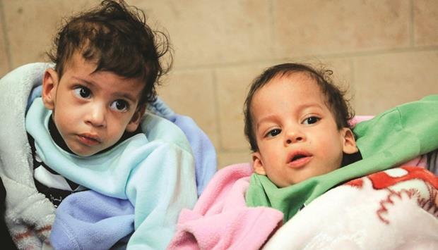 Qatar Yemeni Separated Conjoined Twins Return Home From Jordan Menafn