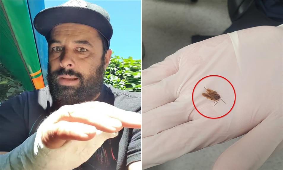 Afghanistan - A man had a cockroach pulled from his ear after three days