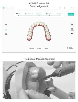 Medical Revolution: AI Firm WEIYUN AI & Robotics Group Launches Orthodontic Smart Alignment System Venus 1.0' - Image