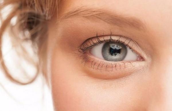 علاجات طبيعية للتخلص من انتفاخ العين بعد التعرف على الأسباب