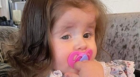 طفلة تأكل خصلات شعرها بسبب حالة صحية نادرة