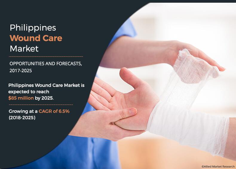 Philippines Wound Care Market Overview 2030 | Top Companies, Business Growth & Investment Opportunity