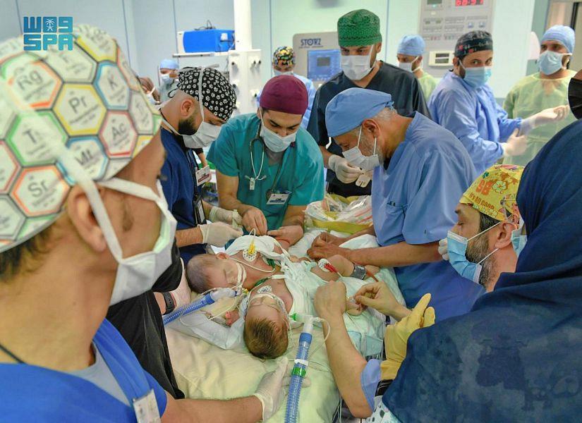 Saudi Arabia Adds New Achievement To Its Record Of Separation Of Conjoined Twins