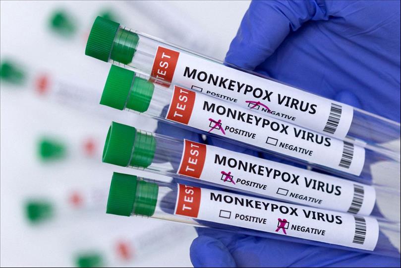 U.S. Confirms Nearly 15,000 Monkeypox Cases