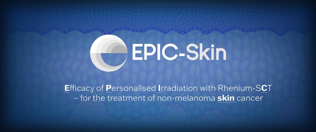 South African Skin Cancer Patients Undergo First Treatments With Oncobeta's Rhenium-SCT As Part Of The EPIC-Skin Study -- Oncobeta Gmbh
