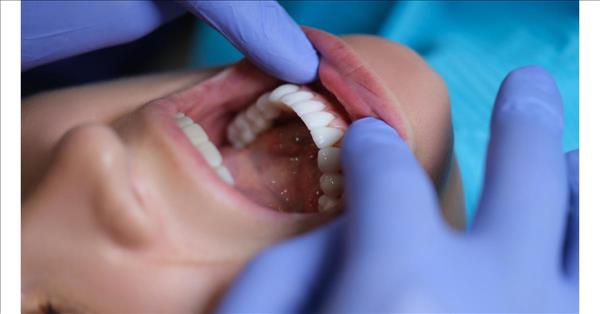 Veneer Dentist In Los Angeles Leads The Way In Smile Transformations At Personal Dental Office