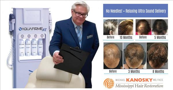 Aquafirme XS Now At MS Hair Restoration: New“No Needle” Ultrasound Technology