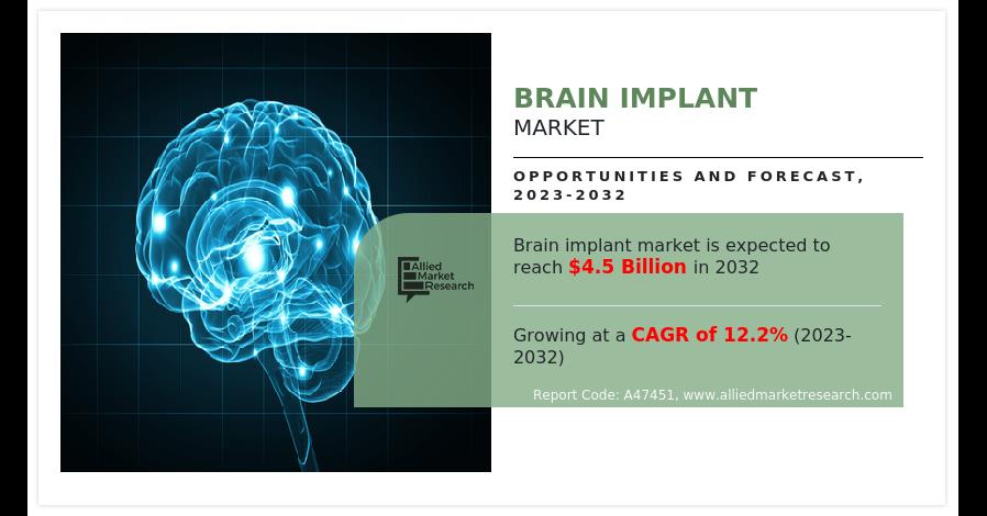 Brain Implant Market Poised To Reach USD 4.5 Billion By 2032, Driven By Impressive 12.2% CAGR