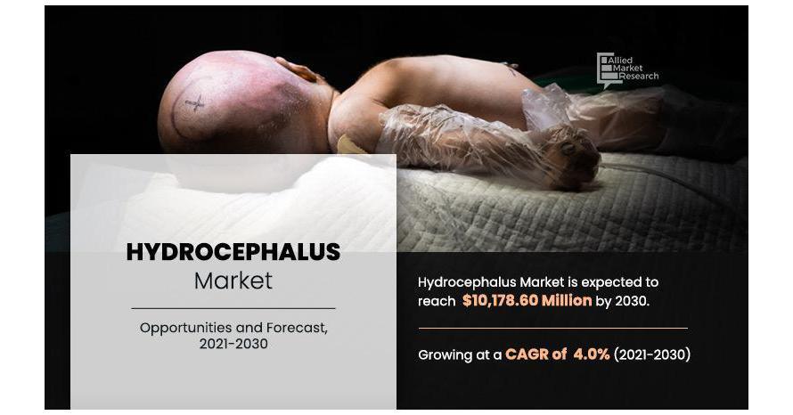 Hydrocephalus Market Analysis: Growth Trends, Treatment Advances, And Emerging Therapies 2030