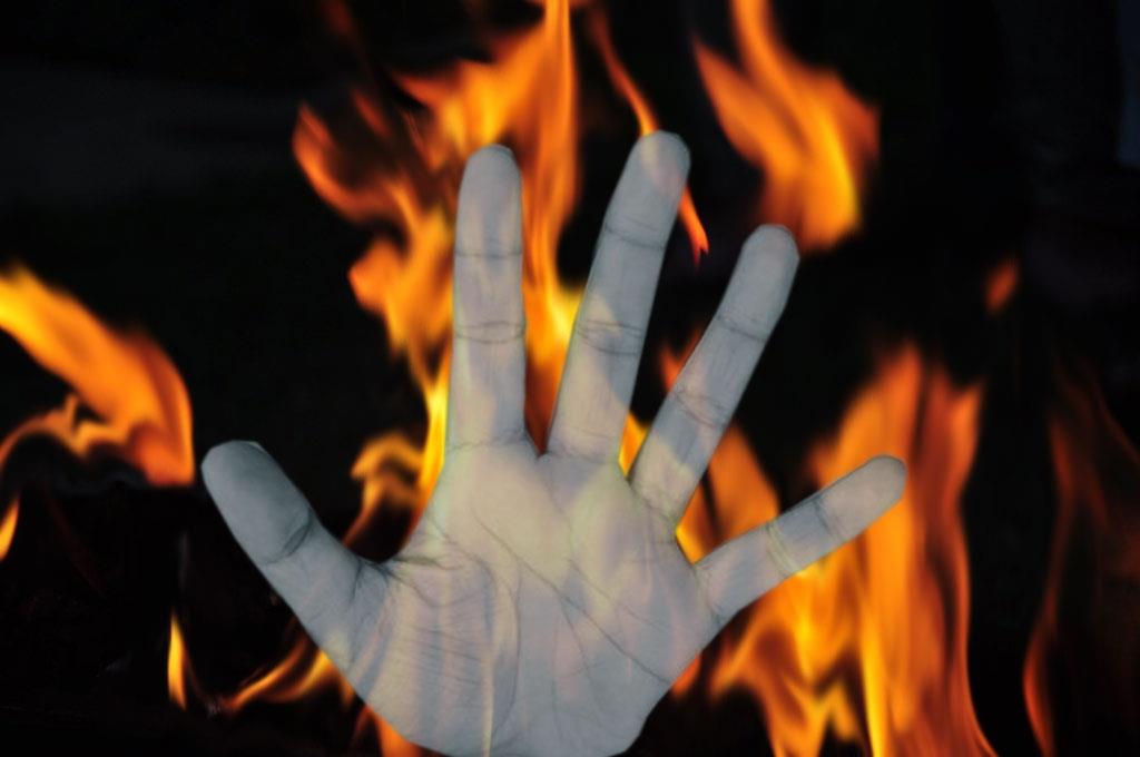  UP Minor Sets Herself On Fire After Constant Harassment By Youth 