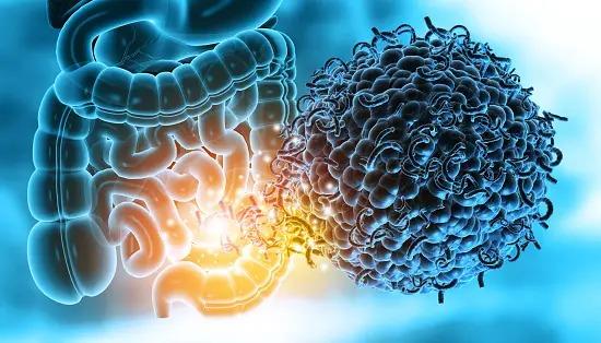 Study Shows Our Gut Microbes May Determine Bone Health