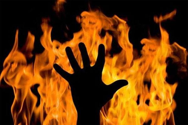 UP: 3 Kids Burnt Alive As Fire Erupts In Hut, Parents Critical