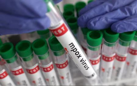 More Mpox Cases Reported In Malawi With Capital Lilongwe Topping National Count More Mpox Cases Reported In Malawi With Capital Lilongwe Topping National Count