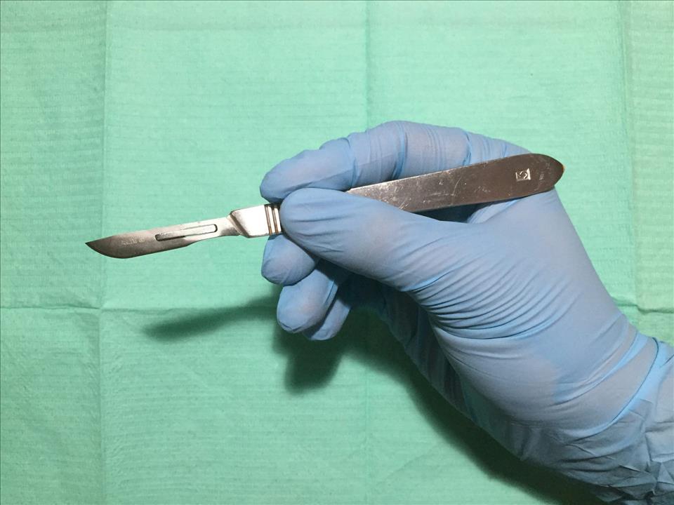 Male Circumcision Is Made Easier By A Clever South African Invention - We Trained Healthcare Workers To Use It Almost all circumcisions are done by surgical cut and stitch techniques, where specially trained surgeons cut off the foreskin with scissors, then sew up the open wound.
          Wikimedia user Rickyblax (CC BY-SA 4.0)