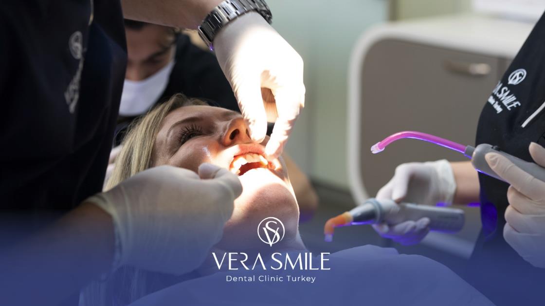 Dental Materials And Implant Systems In Istanbul: What Patients Should Know (2025) Dental Materials And Implant Systems In Istanbul: What Patients Should Know (2025)