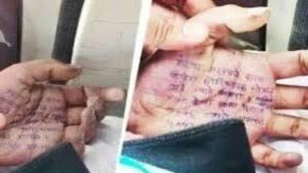 Maharashtra Doctor's Suicide Case: Fresh Revelation-Medic Accused Of Signing Fake Postmortem Report Under Pressure Maharashtra Doctor's Suicide Case: Fresh Revelation-Medic Accused Of Signing Fake Postmortem Report Under Pressure