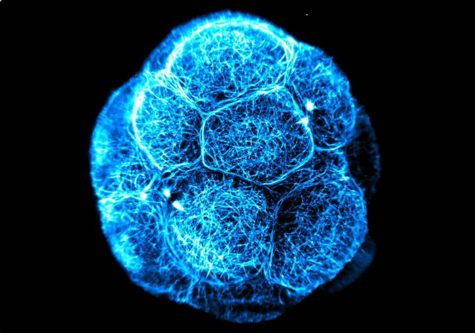 Stem Cells Sound Magical, But They're Not All Created Equal. Here's What You Need To Know An early stage embryo.        Dr Azelle Hawdon, Zenker Lab, Australian Regenerative Medicine Institute