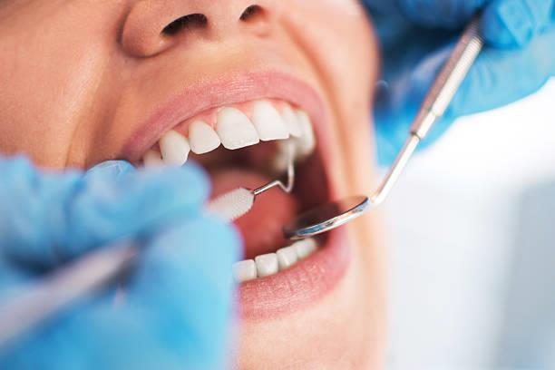 Dental Implants: A Modern Solution Transforming Smiles and Oral Health in Burbank Dental Implants: A Modern Solution Transforming Smiles and Oral Health in Burbank