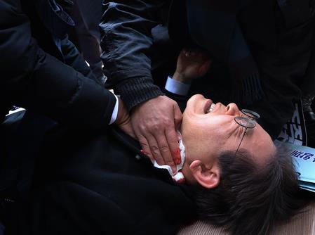 South Korea: Govt Designates 2024 Knife Attack On Lee As Terror Case